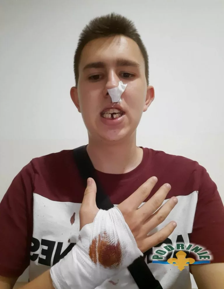 U Bratuncu pretučen Osman zbog nacionalne pripadnosti!? Policija tri dana nakon ovog napada nema zvanične informacije za medije