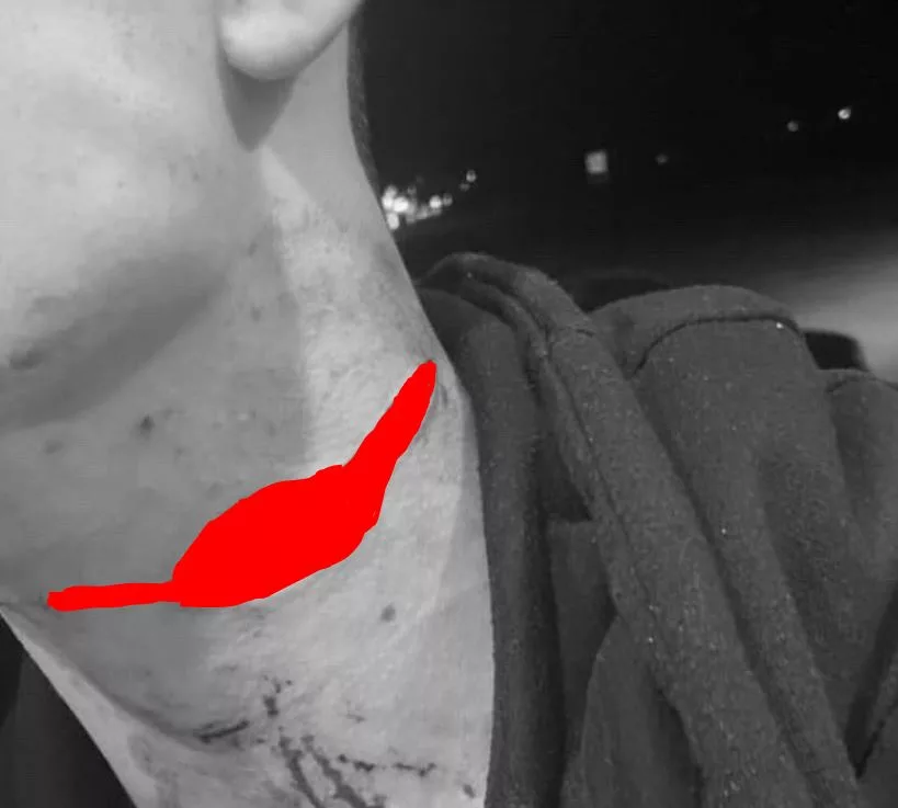 Optužena Zvorničanka koja je nožem ubola u vrat mladog rukometaša "Drine"