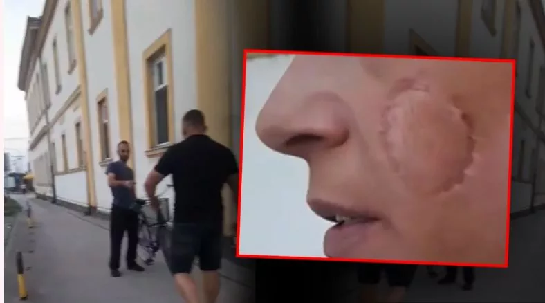 Hrabri mladić slučajno prolazio ulicom i spasio ženu od nasilnika koji ju tukao i ugrizao za obraz (VIDEO)
