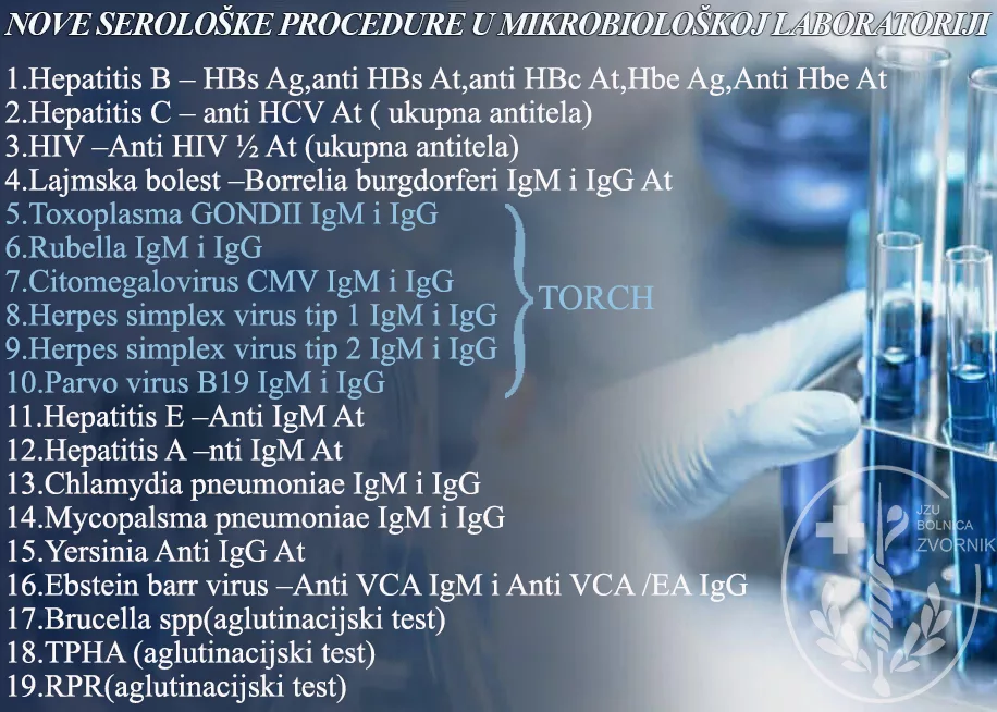 Nove serološke procedure u Mikrobiološkoj laboratoriji JZU “Bolnica” Zvornik