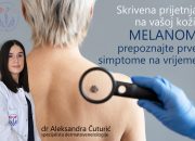 Dr Aleksandra Čuturić, specijalista dermatovenerologije: Melanom šta treba da znate?