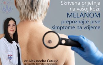 Dr Aleksandra Čuturić, specijalista dermatovenerologije: Melanom šta treba da znate?