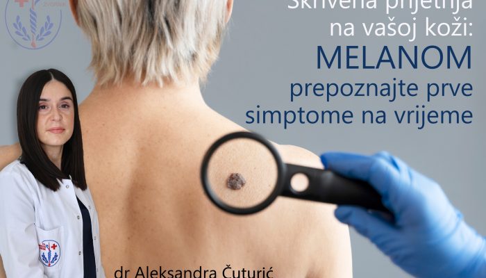 Dr Aleksandra Čuturić, specijalista dermatovenerologije: Melanom šta treba da znate?