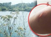 Biljka ”ubica” stigla do Drine? Samo jedan dodir i možete trajno izgubiti vid