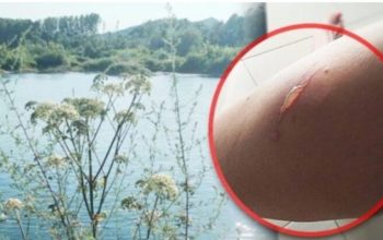 Biljka ”ubica” stigla do Drine? Samo jedan dodir i možete trajno izgubiti vid