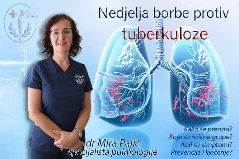 Svjetska sedmica borbe protiv tuberkuloze – najvažnije informacije koje treba da znate