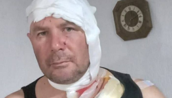 Hrabri lovac preživio napad dva medvjeda na obroncima Konjuha