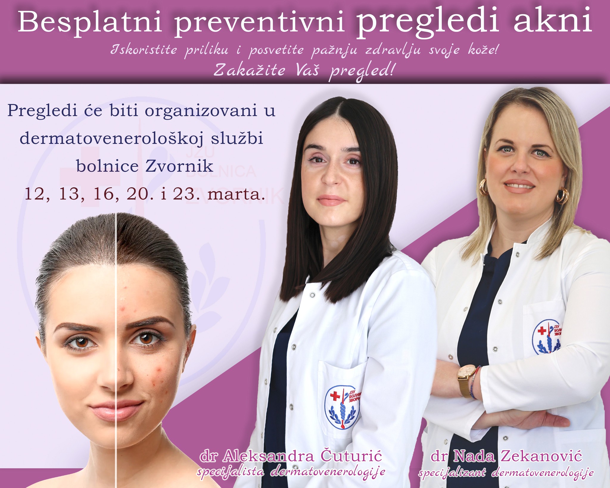 Besplatni preventivni dermatološki pregledi akni u JZU Bolnici Zvornik