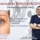 UPOZORENJE: Povećan broj slučajeva zarazne upale oka – konjunktivitisa