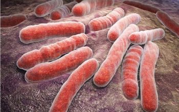 Šta je meningokokna sepsa od koje je preminulo dijete iz Visokog