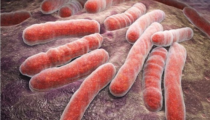 Šta je meningokokna sepsa od koje je preminulo dijete iz Visokog