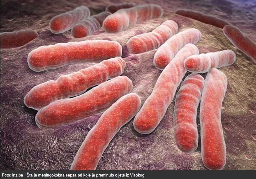 Šta je meningokokna sepsa od koje je preminulo dijete iz Visokog