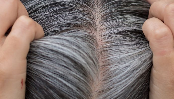 Može li sijeda kosa ponovo potamniti? Evo šta kažu stručnjaci