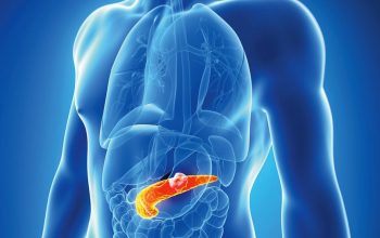 Kako na vrijeme prepoznati žučni kamenac: Simptomi koje ne treba ignorisati