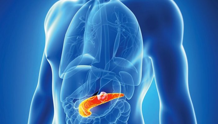 Kako na vrijeme prepoznati žučni kamenac: Simptomi koje ne treba ignorisati