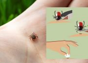 Sezona krpelja je počela: Evo kako se zaštititi i pravilno reagovati nakon uboda