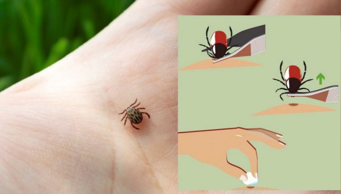 Sezona krpelja je počela: Evo kako se zaštititi i pravilno reagovati nakon uboda